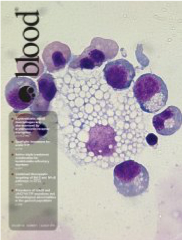 LFKRI researcher Dr. Xuili An's paper appearing on the Cover of the issue of Blood  with an accompanying Commentary, highlighting the importance of her study!  